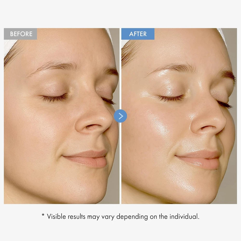 TOSOWOONG Hyaluronic Acid 9 Cream